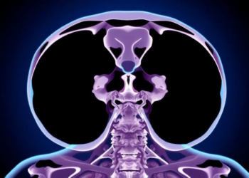 Weekly or Every-Three-Week Cisplatin? Trial Finds Similar Acute Toxicity Burden in p16-Negative Head and Neck Cancer