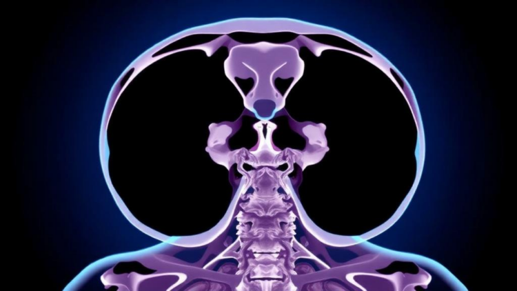 Weekly or Every-Three-Week Cisplatin? Trial Finds Similar Acute Toxicity Burden in p16-Negative Head and Neck Cancer