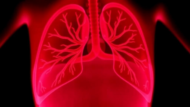 Fetal Lung Drainage Saves Two-Thirds of Babies With Fluid-Filled Chests, Major Review Finds