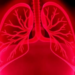 Fetal Lung Drainage Saves Two-Thirds of Babies With Fluid-Filled Chests, Major Review Finds