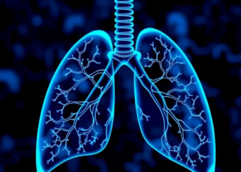 NFAT Transcription Factors Emerge as Central Drivers of Pulmonary Hypertension