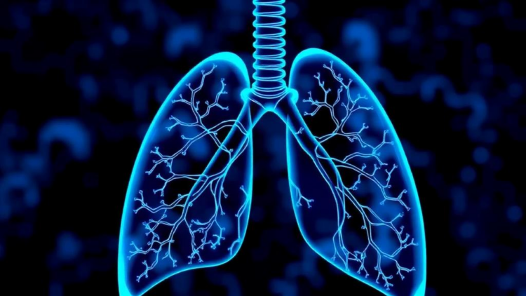 NFAT Transcription Factors Emerge as Central Drivers of Pulmonary Hypertension