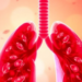 Blood Cell Clues Reveal Who Benefits When Radiotherapy Meets Immunotherapy in Lung Cancer
