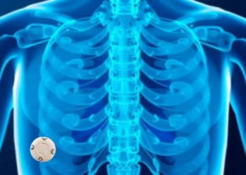 Switching HIV Drugs or Adding Zoledronic Acid Rebuilds Bone Lost to Tenofovir