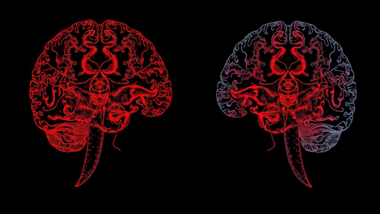 Brain Texture Fingerprints Reveal Two Distinct Schizophrenia Subtypes