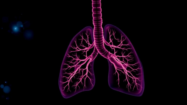 Airway Proteins in First Week of Life Predict Severity of Preterm Lung Disease