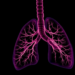 Airway Proteins in First Week of Life Predict Severity of Preterm Lung Disease