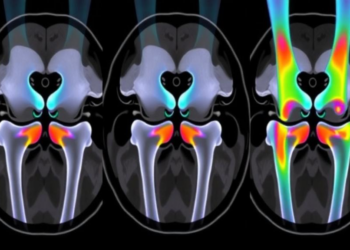 MRI Maps How the Child Knee Grows: ACL, Notch and Growth Plate Development Tracked by Age and Sex