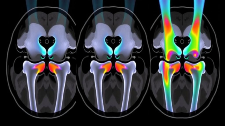 MRI Maps How the Child Knee Grows: ACL, Notch and Growth Plate Development Tracked by Age and Sex