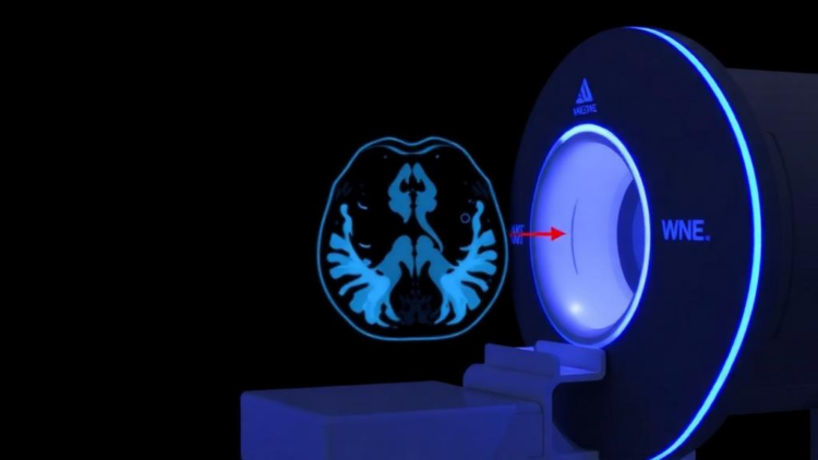 AI-Designed PET Probe Reaches First Human Test for Imaging PARP-1 in Cancer