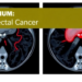 AI Reads Rectal Cancer MRI Scans to Spot Dangerous Blood Vessel Invasion