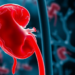 Bacterial Biofilms May Trigger the Autoantibodies Behind Lupus Kidney Damage