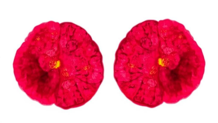 Two Approved Companion Diagnostics Validate Pembrolizumab Eligibility Across dMMR/MSI-H Tumors