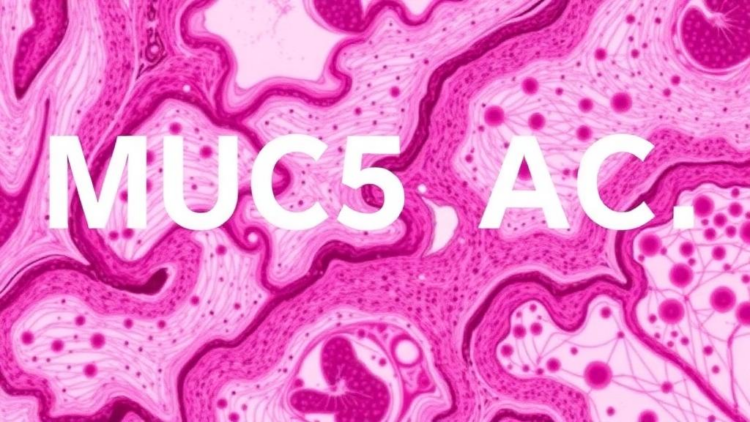 Sticky Protein MUC5AC Emerges as Powerful Tissue Marker for Pancreatic Cancer and Precursors