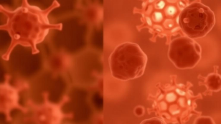 Iron, Lipids and Cell Death: Ferroptosis Biomarkers Emerge as Clues to Vitiligo Activity