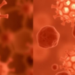 Iron, Lipids and Cell Death: Ferroptosis Biomarkers Emerge as Clues to Vitiligo Activity