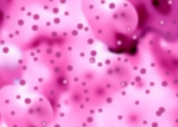Neutrophils Fail Quietly in Multiple Myeloma Even When Counts Look Normal
