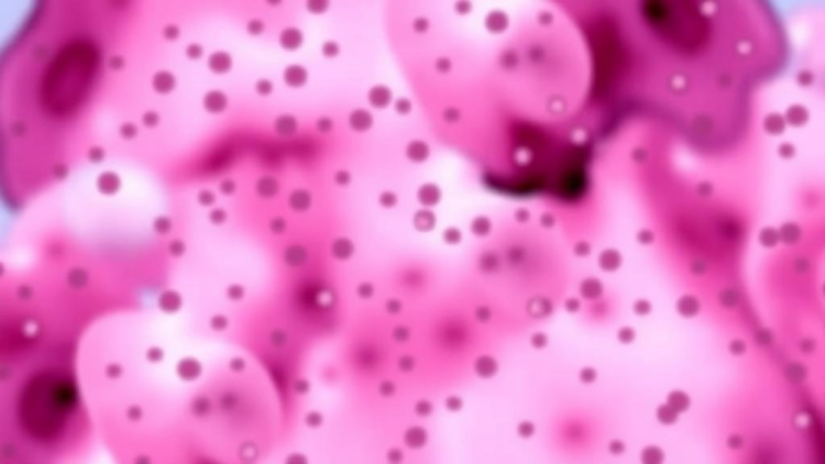 Neutrophils Fail Quietly in Multiple Myeloma Even When Counts Look Normal