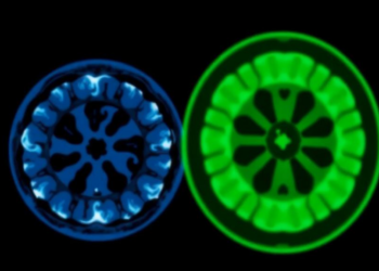 AI Model Sharpens Low-Dose CT Scans While Cutting Radiation Exposure