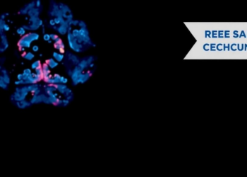 Is CBL Really a Melanoma Driver? Variant Interpretation Under Scrutiny in Stage II Disease