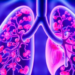 Antibody-Drug Conjugate Shows Striking First-Line Results in HER2-Driven Lung Cancer