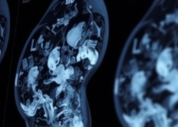 AI Reads Routine Mammograms to Predict Breast Cancer HER2 Status Without Biopsy