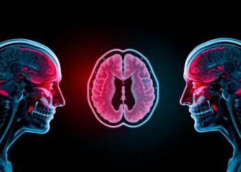 Splitting Radiation Into Multiple Sessions Cuts Recurrence After Brain Metastasis Surgery