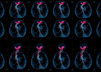 AI Reads Whole Coronary Angiograms and Predicts Heart Risk a Year Ahead