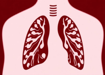 Drug-Resistant Tuberculosis Clones Are Quietly Spreading Beyond Their Historic Heartlands