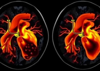 MRI Maps Heart Blood Flow Without Contrast Dye in Young Heart Patients