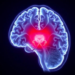 Weekly MRI Reveals Radiation’s Early Fingerprint on the Brain’s Memory Hub