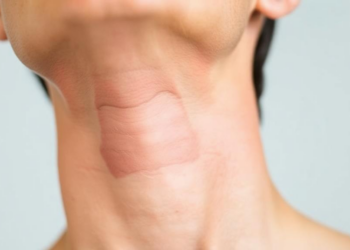 Skin Darkening on the Neck May Reveal Hidden Insulin Overload Before Blood Sugar Rises