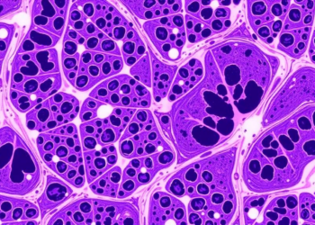 AI Trained Only on Adult Biopsies Accurately Diagnoses Coeliac Disease in Children