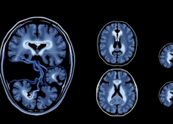 AI Reads Routine MRI Scans to Predict Survival in Children with Brain Cancer