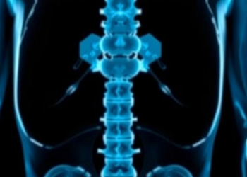 AI Body Composition Scans Hold Steady Across CT Reconstruction Algorithms, Study Finds