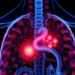 AI Reads the Tumor and Its Surroundings to Predict Surgery Risks in Thymoma Patients