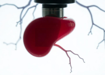 When the Mirror-Body Meets the Microscope: A Liver-like Spleen in Situs Inversus Totalis