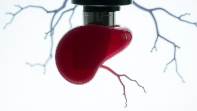 When the Mirror-Body Meets the Microscope: A Liver-like Spleen in Situs Inversus Totalis