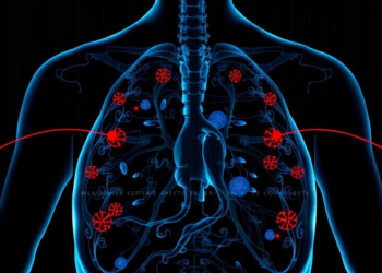 Routine Patient Data Reveals Hidden Patterns of Cancer Cachexia in Landmark Study