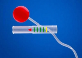 Simple DNA Biosensor Delivers Rapid Screening for Southeast Asian α-Thalassemia Deletion