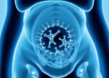 Childhood Intussusception Rates Collapsed During COVID Lockdowns—Then Bounced Right Back
