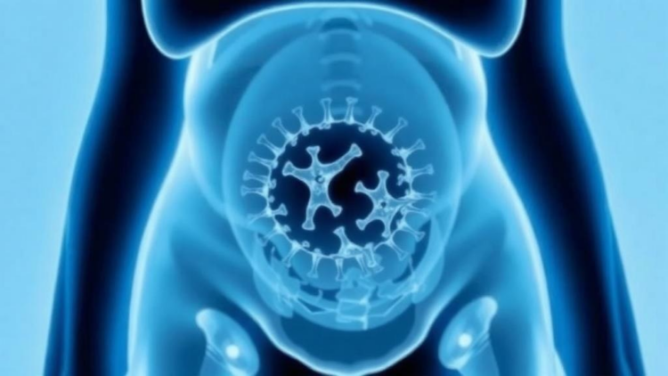 Childhood Intussusception Rates Collapsed During COVID Lockdowns—Then Bounced Right Back