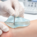 Superoxidized Hydrogel Gel Shows Promise Against Pin-Site Infections in Pilot Trial