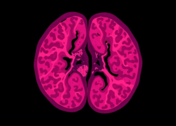 Advanced stage at diagnosis and aggressive histology dominate prostate cancer presentation in Kenya: a registry analysis