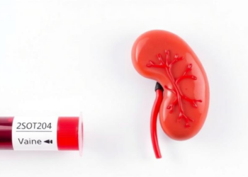 A Simple Blood Test Calculation Predicts Who Will Progress to the Deadliest Stage of Cardiovascular-Kidney-Metabolic Syndrome
