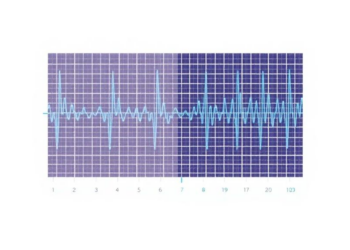New EEG Algorithm Predicts Anesthesia Sensitivity in First 10 Minutes