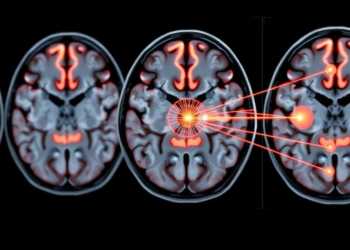 Physicists Borrow Quantum Mechanics to Map Brain Tumors on MRI Scans