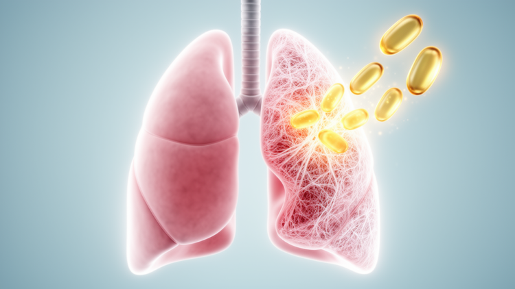 Antifibrotic Drug Pirfenidone Cuts Lung Injury Risk in Immunotherapy-Treated Lung Cancer Patients