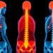 AI Turns Routine Spine Scans Into a Full 3D Map of Bone and Muscle Health in Osteoporosis