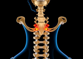 Two Plates May Be Enough: Study Finds Sweet Spot for Rebuilding Cheekbone Fractures